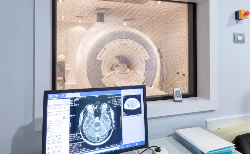 Radiologie interventionnelle : Types, avantages et inconvénients