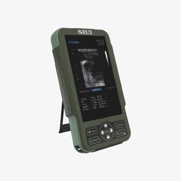 Ecógrafo SIUI altas prestaciones CTS800 Neo con una sonda