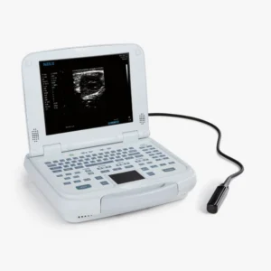 Ecógrafo SIUI CTS900 Neo con una sonda