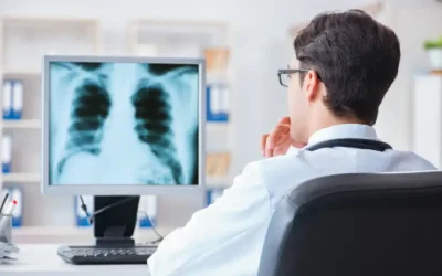 Radiografía computarizada: Cómo funciona y flujo de trabajo