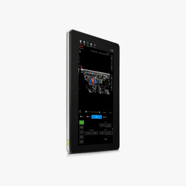 WISONIC PILOTER Ecógrafo Smart Tablet