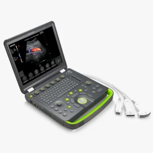 Wisonic Glover Vet Ultrasound Scanner