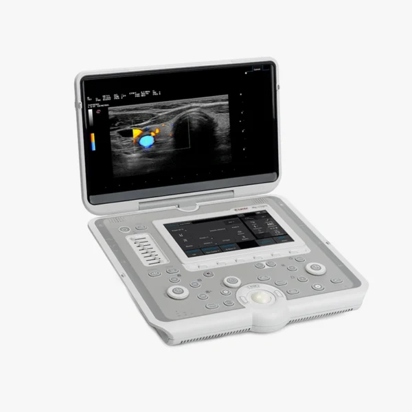 Ecógrafo Esaote MyLab Sigma – Image 2