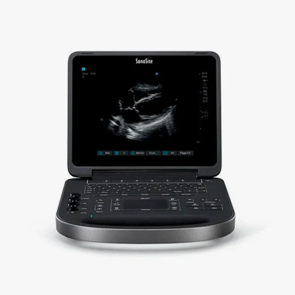 Échographe Sonosite Edge II