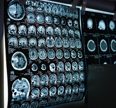 imagen-flatpanel-4d-medica