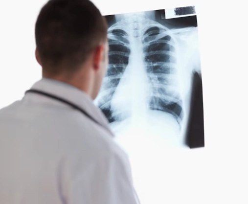 imagen-rayos-x-poratiles-4d-medica-3